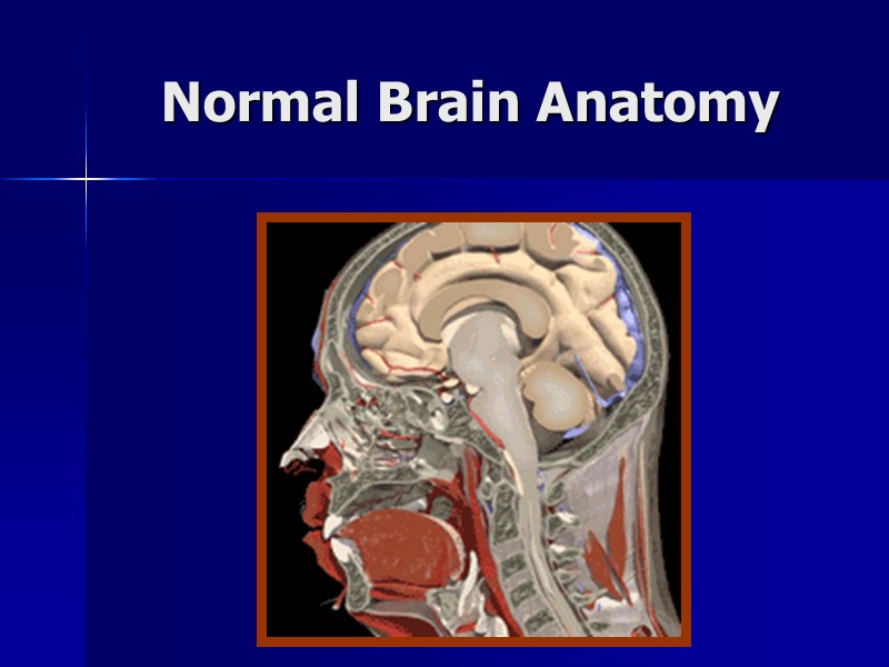 Normal Brain Anatomy